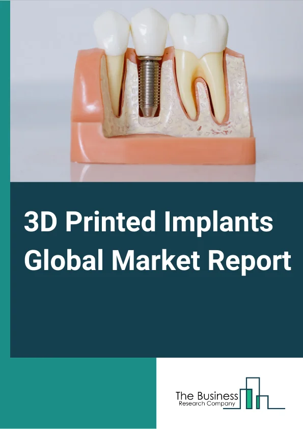 3D Printed Implants Global Market Report 2025 – By Implantation Technology (Laser Beam Melting, Electronic Beam Melting, Droplet Deposition, Laminated Deposition, Two-photon Polymerization), By Application (Dental, Orthopedic, Cranio-maxillofacial), By End Users (Medical And Surgical Centers, Pharmaceutical Companies, Biotechnology Industry, Medical Institution) – Market Size, Trends, And Global Forecast 2025-2034